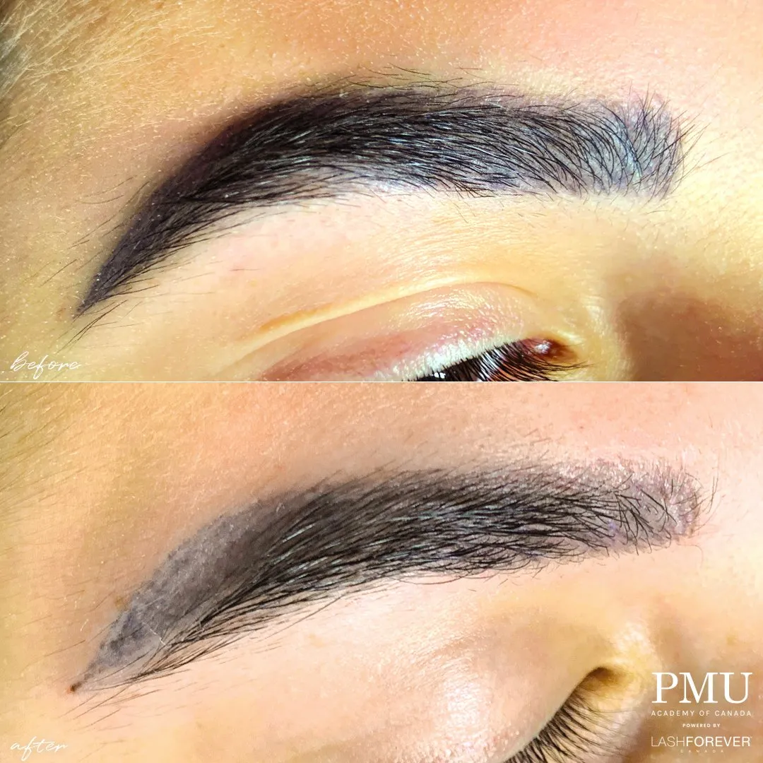 Three-in-One Advanced Colour Correction & Removal Course