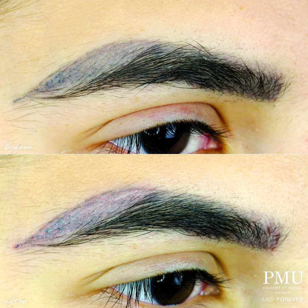 Three-in-One Advanced Colour Correction & Removal Course